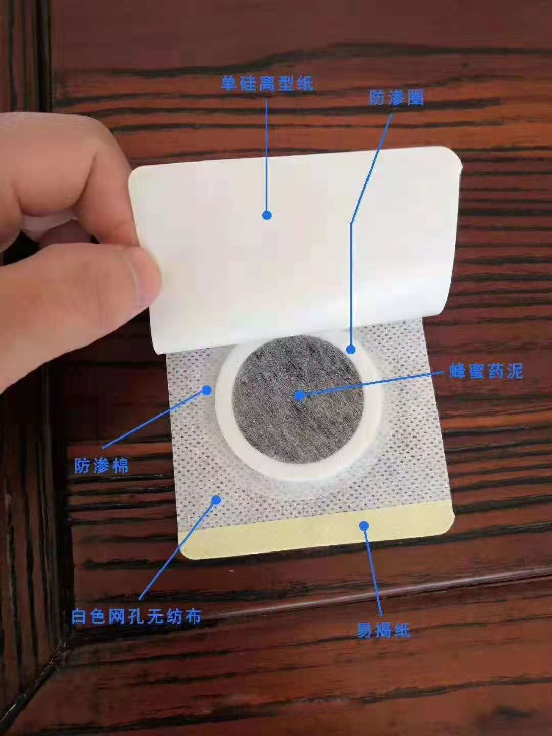 穴位壓力刺激貼。